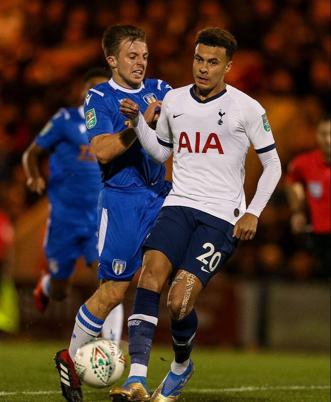 日媒：日本国门铃木彩艳预计13日在日本接受手指骨折手术（日媒称日本门将铃木彩艳预计13日于国内接受手指骨折手术）